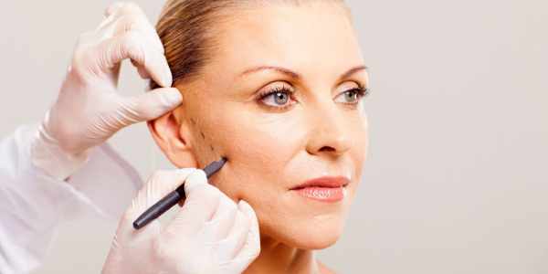 Facial sagging