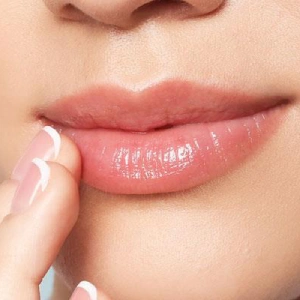 Recuperación — Aumento de labios con ácido hialurónico