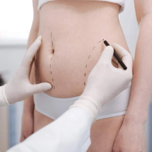 Initial assessment — Body mesotherapy in Nerja