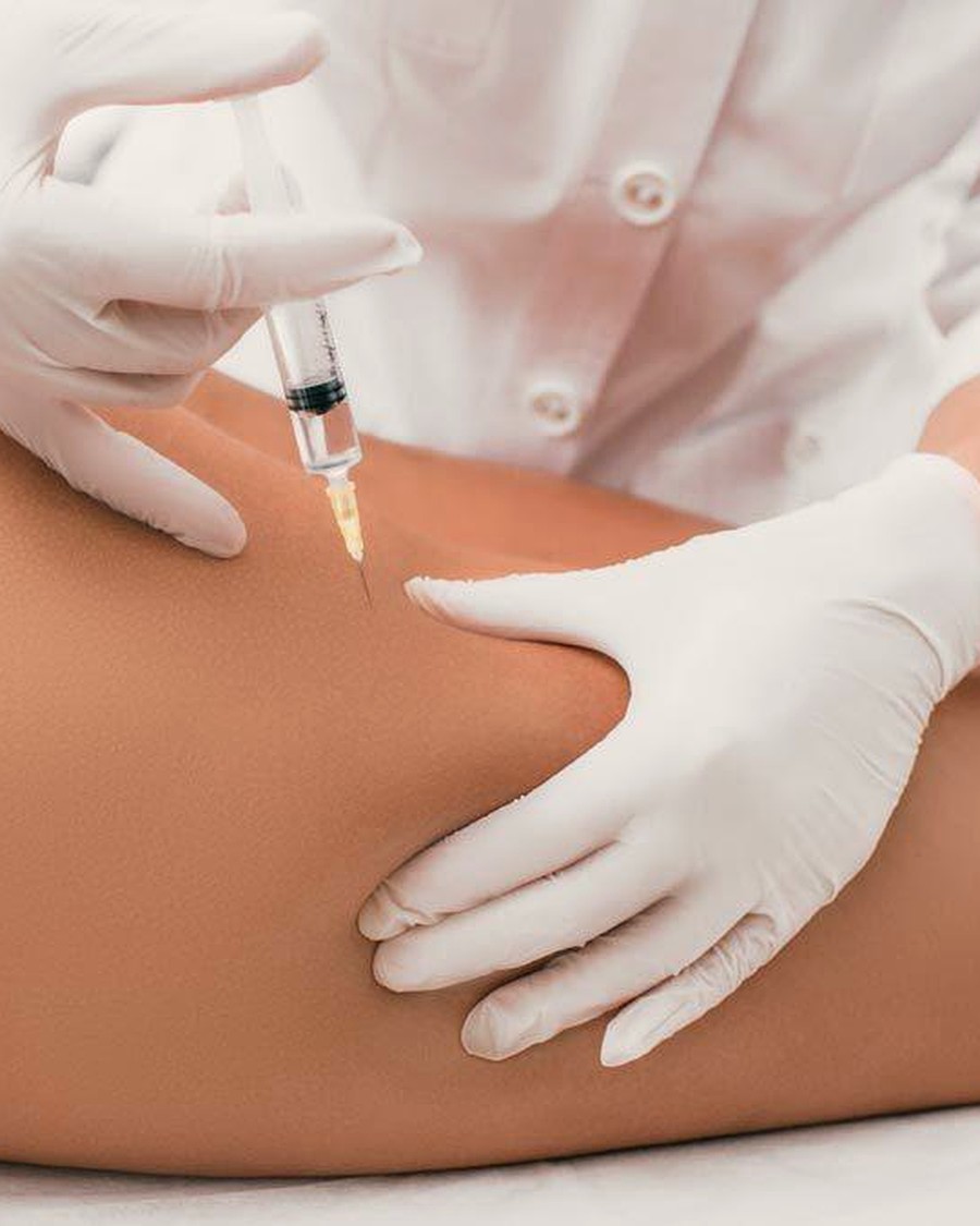 Body mesotherapy in Nerja