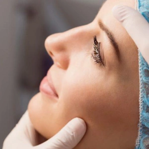 Initial assessment — Chemical peel