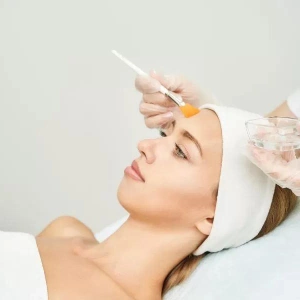 Procedure — Chemical peel