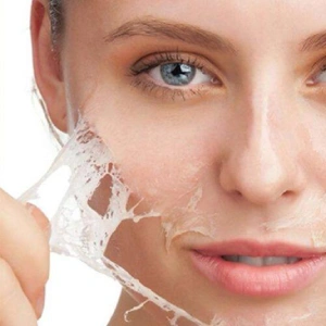 Recovery — Chemical peel