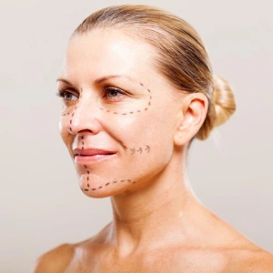 Full Face Treatment