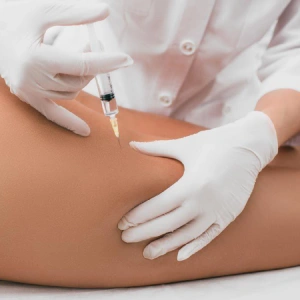 Procedure — Body mesotherapy in Nerja