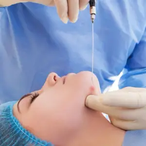 Procedimiento — Eliminación de papada en Nerja