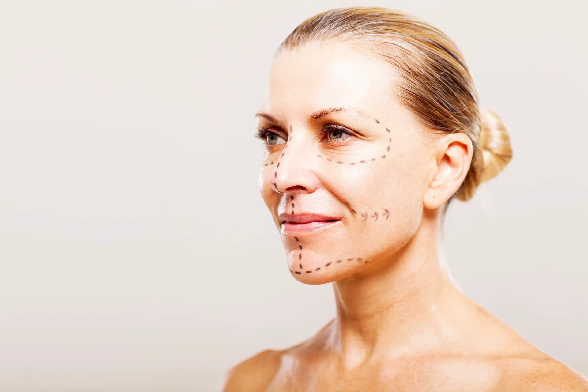 Full Face-behandling