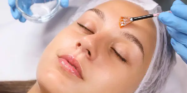 Peeling antiedad