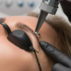 Procedure — Microblading and micropigmentation removal