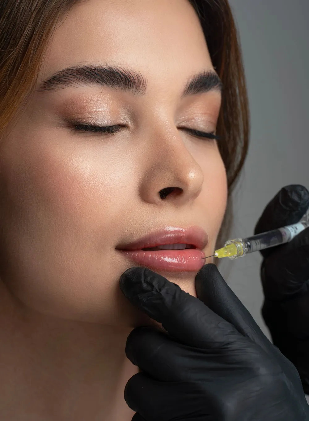 Lippenvergrößerung mit Hyaluronsäure