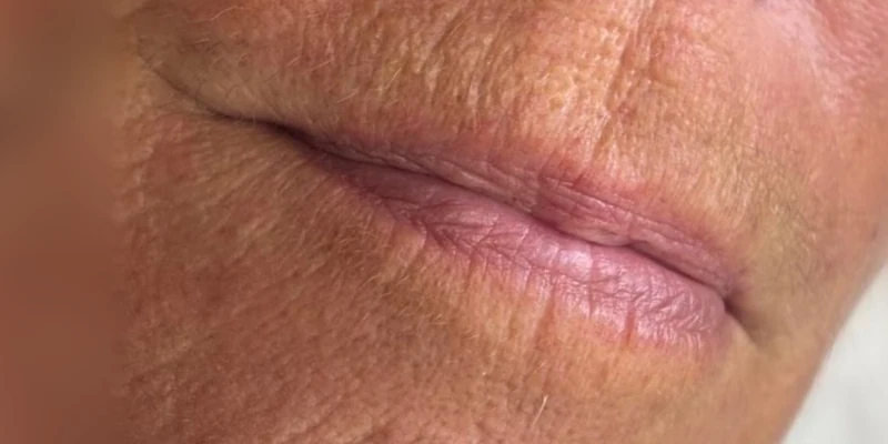 Before — Micropigmentación de labios – Elena Cotrina